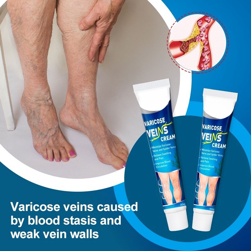 FreeShipping Buy 1 get 4 free Varicose vein body Cream Tendon-dredge body Cream