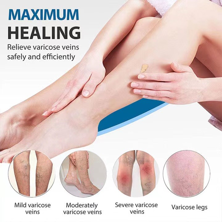 FreeShipping Buy 1 get 4 free Varicose vein body Cream Tendon-dredge body Cream