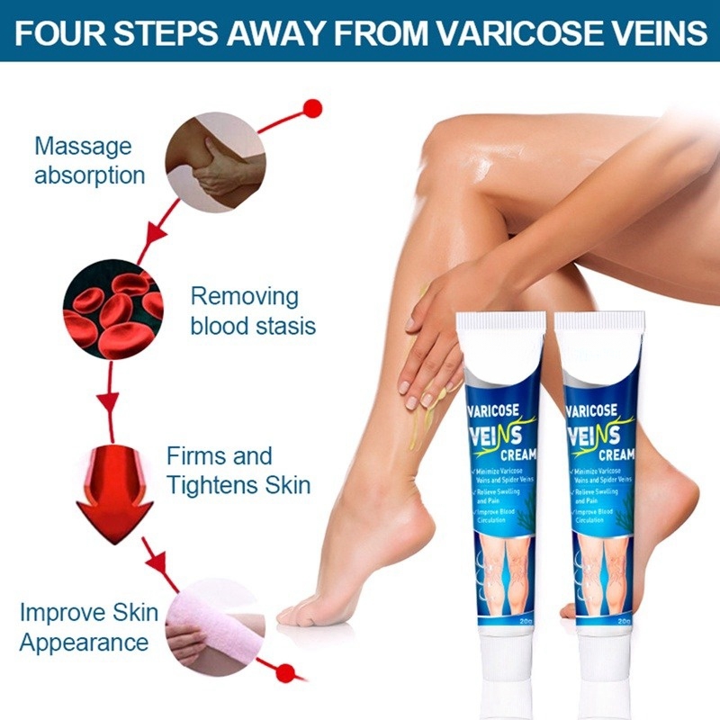 FreeShipping Buy 1 get 4 free Varicose vein body Cream Tendon-dredge body Cream