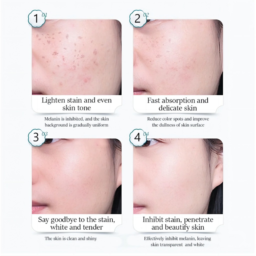 FreeShipping Philippines BUY 2 TAKE 3 Japanese Melasma Cream Yunnan Herbal Whitening Freckle Cream Original Whitening remover cream for face effective anti-aging FreeShipping Philippines BUY 2 TAKE 3 Japanese Melasma Cream Yunnan Herbal Whitening Freckle Cream Original Whitening remover cream for face effective anti-aging