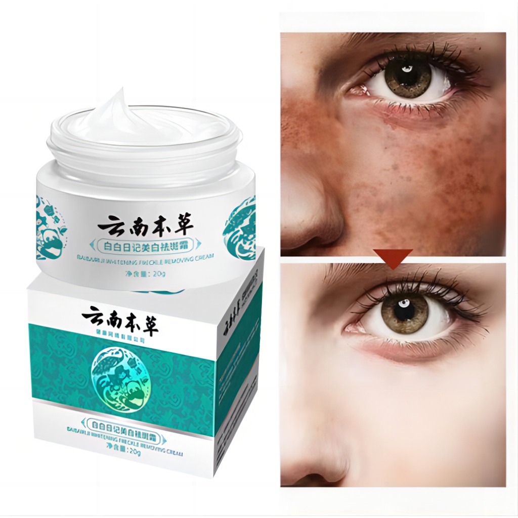 FreeShipping Philippines BUY 2 TAKE 3 Japanese Melasma Cream Yunnan Herbal Whitening Freckle Cream Original Whitening remover cream for face effective anti-aging FreeShipping Philippines BUY 2 TAKE 3 Japanese Melasma Cream Yunnan Herbal Whitening Freckle Cream Original Whitening remover cream for face effective anti-aging